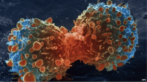 Cancer image